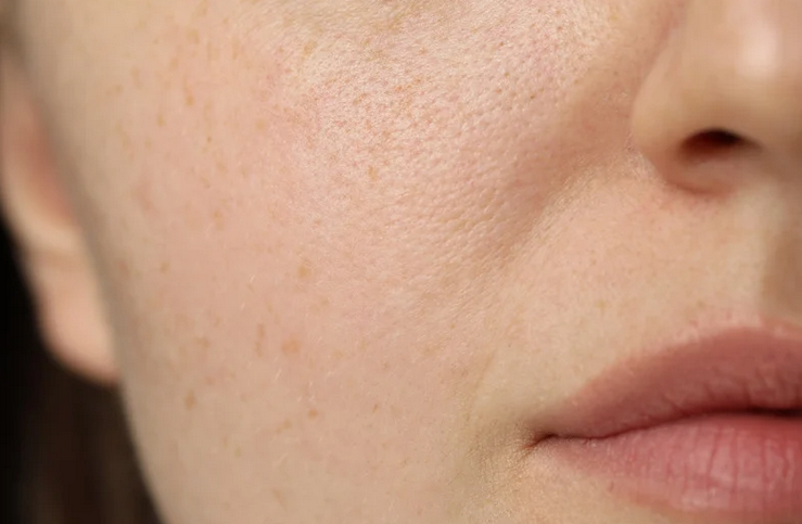 Tout savoir sur la peau sensible : causes, soins et erreurs à éviter